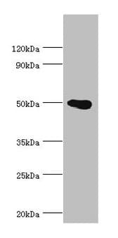 Polyclonal Rabbit anti-Human PRMT2 Antibody (aa1-300, IHC, WB)