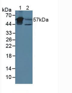 KRT4 / CK4 / Cytokeratin 4 Antibody (aa152-457, Cy3)