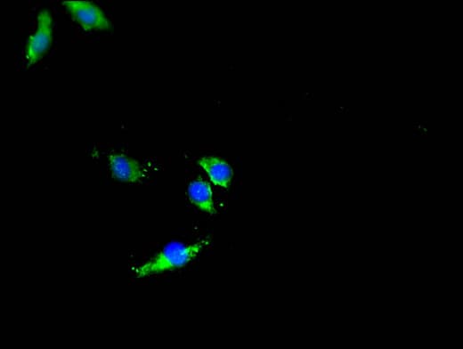 Polyclonal Rabbit anti-Human DNMT3L Antibody (IF)