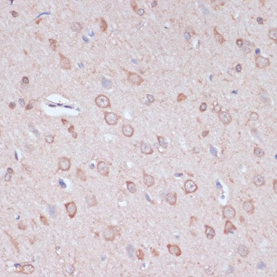 CARTPT / CART Antibody
