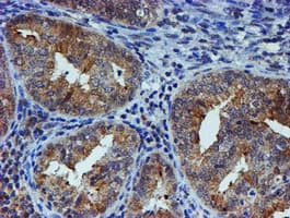 ER Alpha / Estrogen Receptor Antibody (clone OTI1B1)