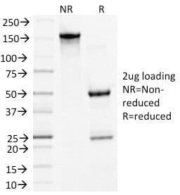 Monoclonal Mouse anti-Human DSG3 / Desmoglein 3 Antibody (clone 5G11, IHC, IF, WB)