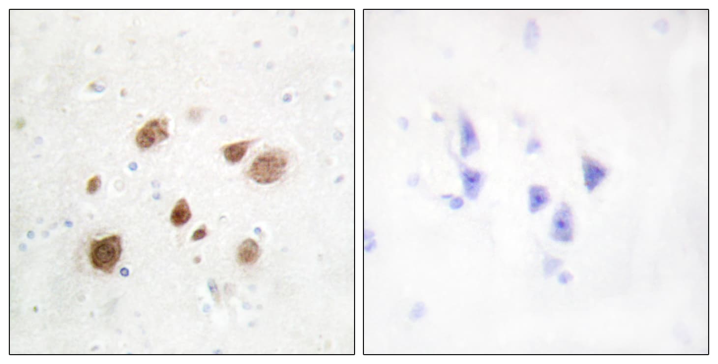 PNCK / CaMK1b Antibody (aa161-210)