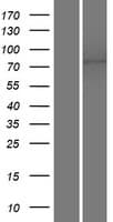 ANO10 / TMEM16K Protein (Over-Expression Lysate Myc-DDK (Flag))