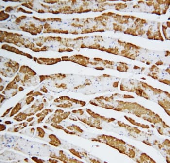 FABP3 / H-FABP Antibody (aa119-133)