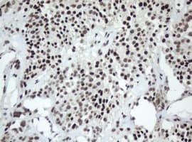 SF3A1 / SF3A120 Antibody (aa249-568, clone OTI2C4, Carrier-free)
