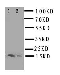 E-FABP / FABP5 Antibody (aa10-23)