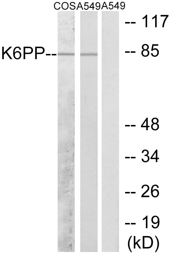 PFKP Antibody (aa341-390)