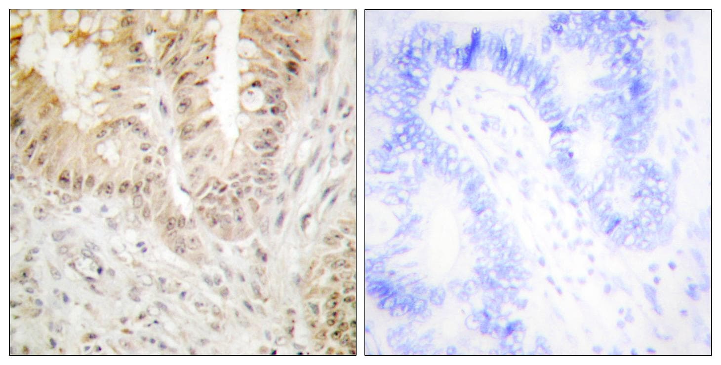 ATF2 Antibody (Ab-480)