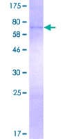 Human FECH / Ferrochelatase Protein (Recombinant GST)