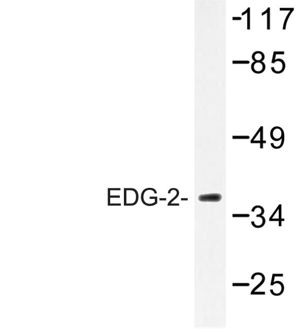 IHC-plus™ LPAR1 / LPA1 / EDG2 Antibody (Trp45)