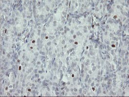 Monoclonal Mouse anti-Human MAFB Antibody (clone OTI2A6, IHC, WB)