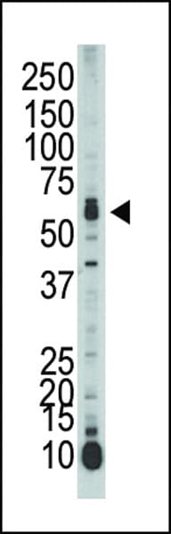 STK39 / SPAK Antibody (aa346-376)