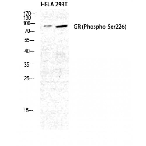 Polyclonal Rabbit anti-Human NR3C1/Glucocorticoid Receptor Antibody (180-260 aa, IHC, WB)
