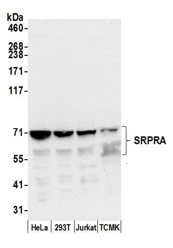 SRPR Antibody (aa225-275)