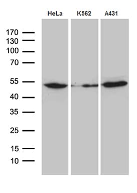 ACTR3 Antibody (aa2-418, clone OTI2B9)