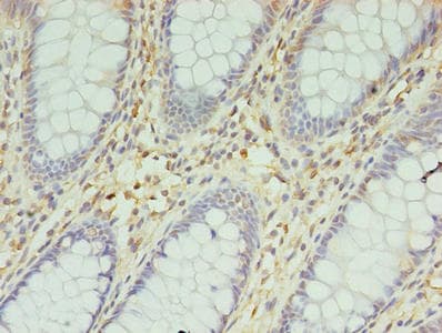 Polyclonal Rabbit anti-Human ENO3 / Enolase 3 Antibody (IHC, WB)