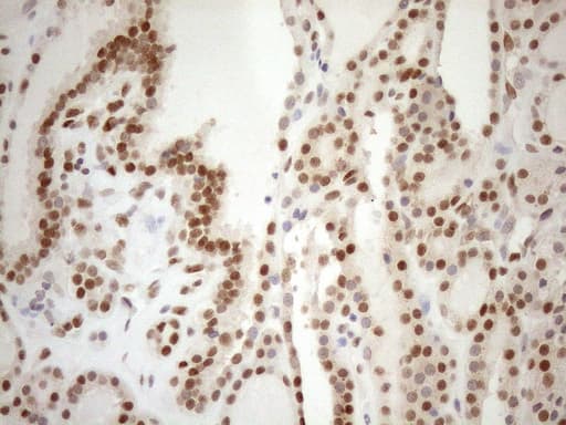 Monoclonal Mouse anti-Human MGMT Antibody (clone OTI2F10, IHC, WB)