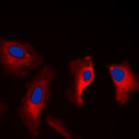 YWHAZ / 14-3-3 Zeta Antibody (C-Terminus)
