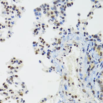BAZ1B / WSTF Antibody