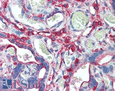 IHC-plus™ CLTC / Clathrin Heavy Chain Antibody