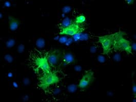 BAIAP2 / IRSP53 Antibody (clone OTI1C10)