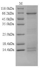 Human DSG1 / Desmoglein 1 Protein (Recombinant 10His, N-terminus + Myc, C-terminus)