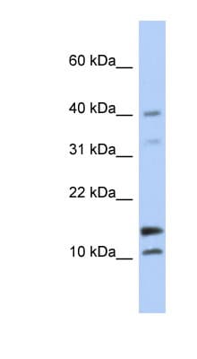 WFDC5 / PRG5 Antibody (N-Terminus)
