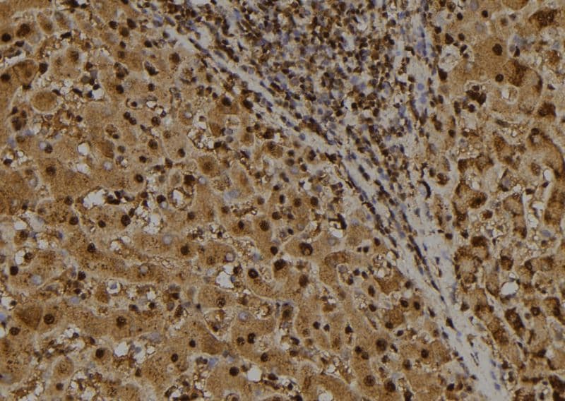 Polyclonal Rabbit anti-Human IRF7 Antibody (IHC, WB)