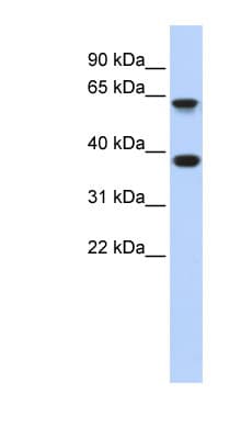 EPN2 Antibody (aa431-480)