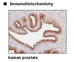 SLC2A13 / HMIT / GLUT13 Antibody