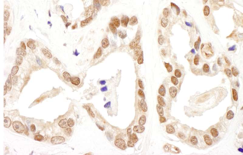 Polyclonal Rabbit anti-Human FANCD2 Antibody (aa1401-1451, IHC, WB)