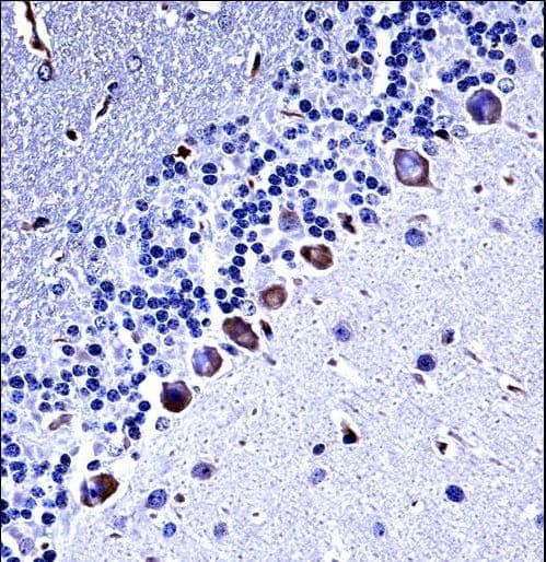 CSNK1G3 / CKI-Gamma 3 Antibody (aa333-361)