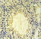 UBXN6 / UBXD1 Antibody (aa281-309)