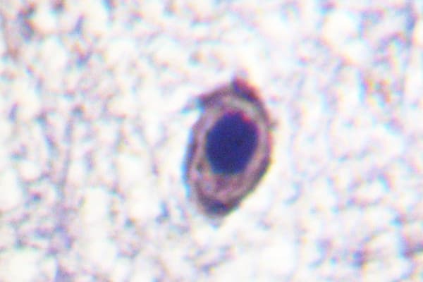 NTRK1 / TrkA Antibody (Ala785)