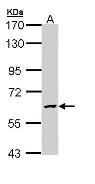 GALNS / Chondroitinase Antibody (aa20-259)
