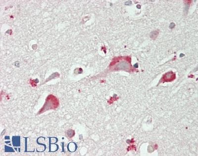 IHC-plus™ Polyclonal Rabbit anti-Human KCNMB2 Antibody (Internal, IHC, WB)
