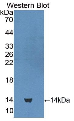 CUBN / Cubilin Antibody (aa3157-3274, Cy3)