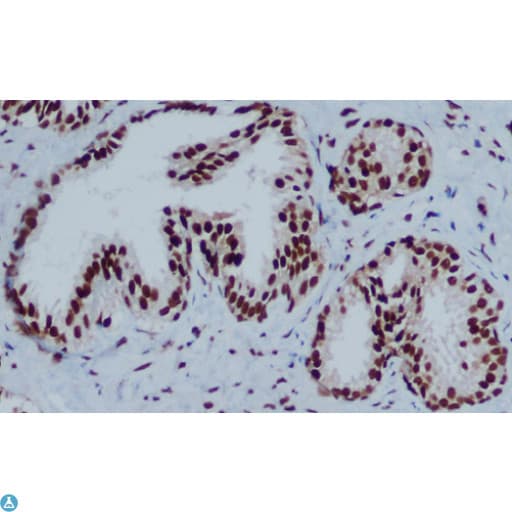 CBX3 / HP1 Gamma Antibody