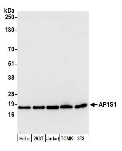 Polyclonal Rabbit anti-Human AP1S1 Antibody (aa108-158, WB)