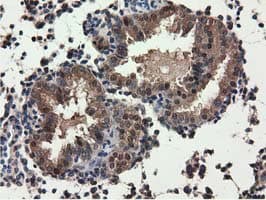 QPRT Antibody (clone OTI1C10, Carrier-free)