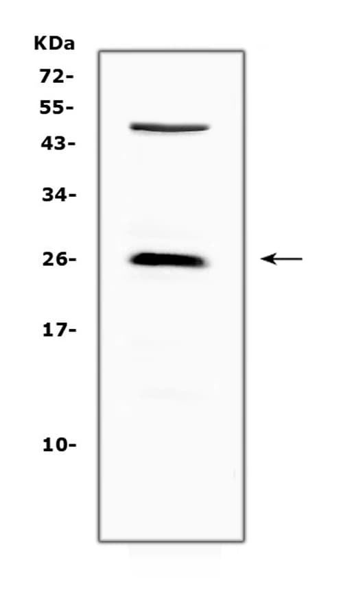 CTLA4 / CD152 Antibody (aa36-161)