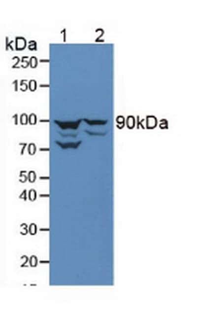 PathPlus™ CTNNB1 / Beta Catenin Antibody