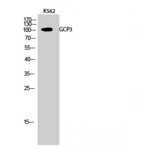 Polyclonal Rabbit anti-Human GCP3 / TUBGCP3 Antibody (180-260 aa, Internal, IHC, WB)