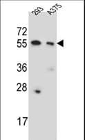 Polyclonal Rabbit anti-Human CPNE8 / Copine VIII Antibody (aa73-101, IHC, WB)