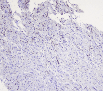 Polyclonal Rabbit anti-Human MOG Antibody (IHC, WB)