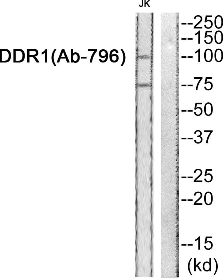 Polyclonal Rabbit anti-Human NEP / DDR1 Antibody (p796, WB)
