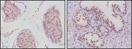 Monoclonal Mouse anti-Human AR / Androgen Receptor Antibody (clone 2H8, IHC, WB)