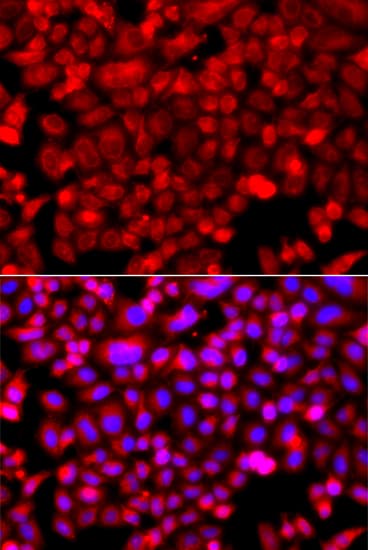 NDUFV1 Antibody