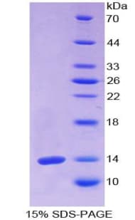 Human OLFM4 / Olfactomedin 4 Protein (Recombinant His)